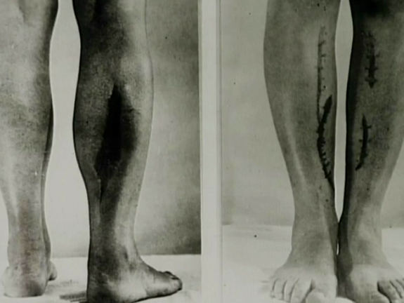 Zwei paar Beine mit Verletzungen, die durch medizinische Versuche entstanden